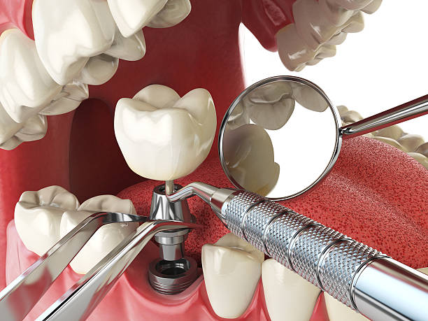 Best Emergency Cosmetic Dentistry in New Hope, AL