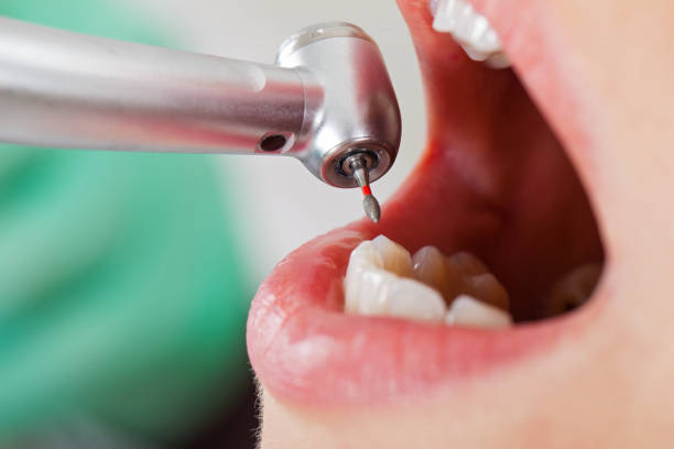 Best Orthodontic Emergency Dentist in New Hope, AL